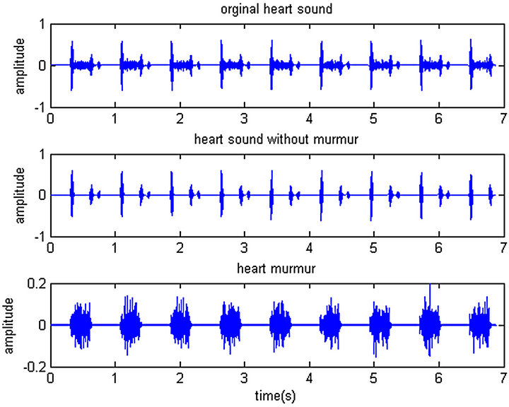 Сердечные тоны шумы. Функциональные шумы сердца, данные ФКГ. Классификация шумов сердца пропедевтика. Функциональный систолический шум. Патологические шумы сердца.